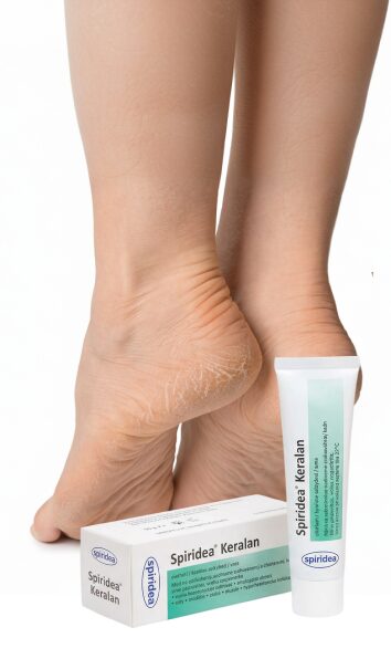 Dry heels and feet